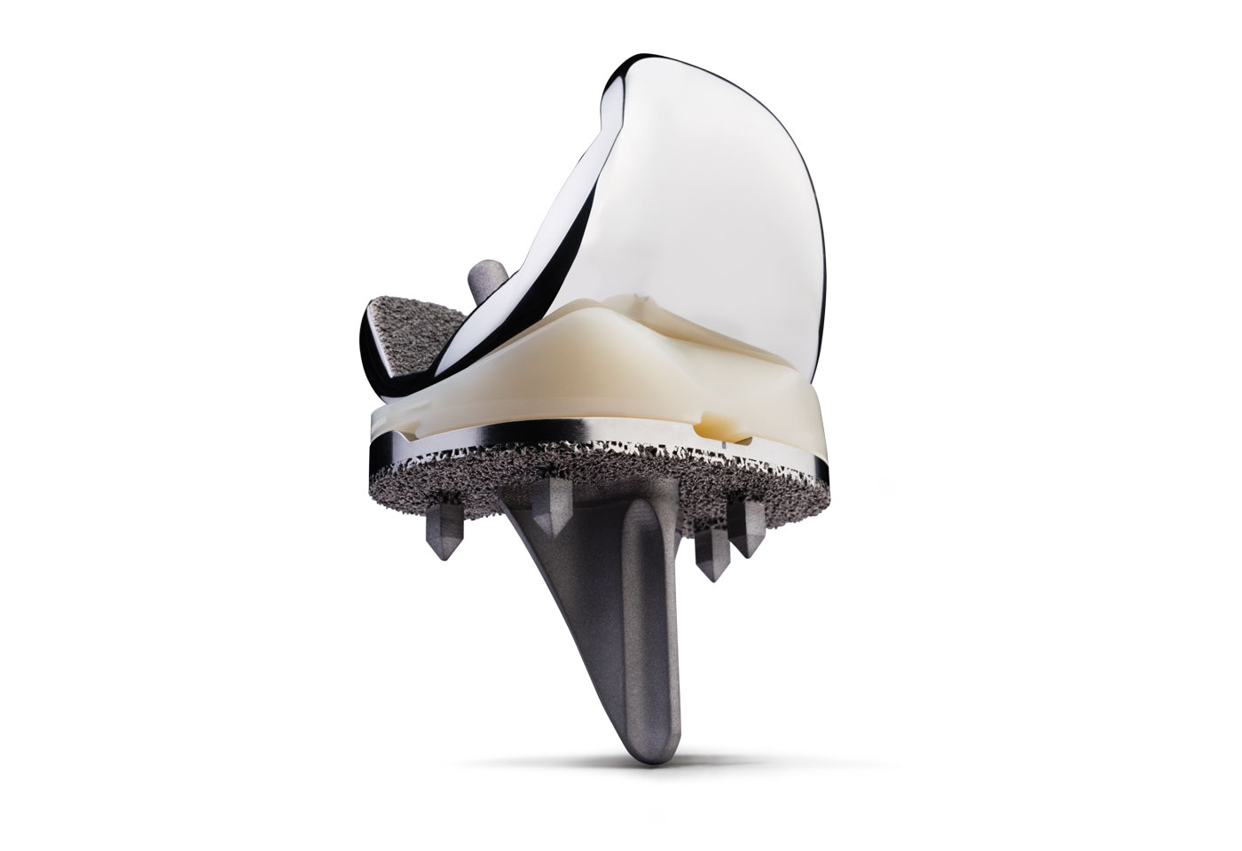 Persona Personalized Knee 